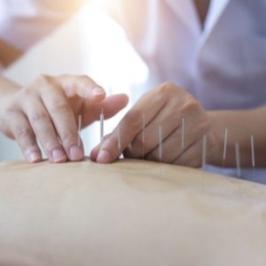Medicina Tradicional Chinesa